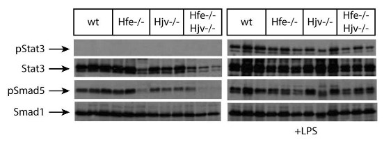 Livers of Hjv-deficient mice retain inflammatory Smad signaling, presumably via activin B.jpg